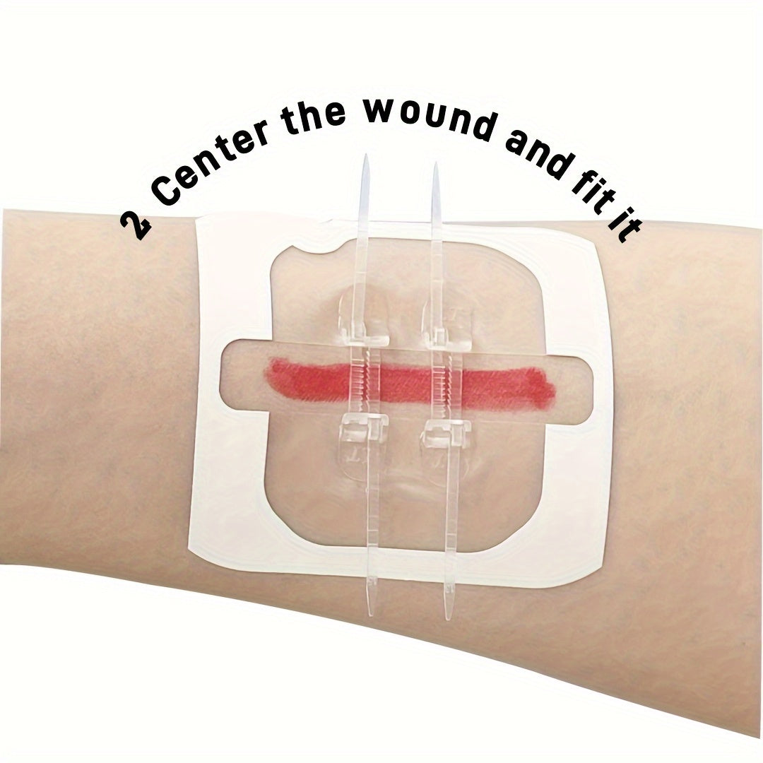 Self-Adhesive Zipper Wound Closure Tape Kit