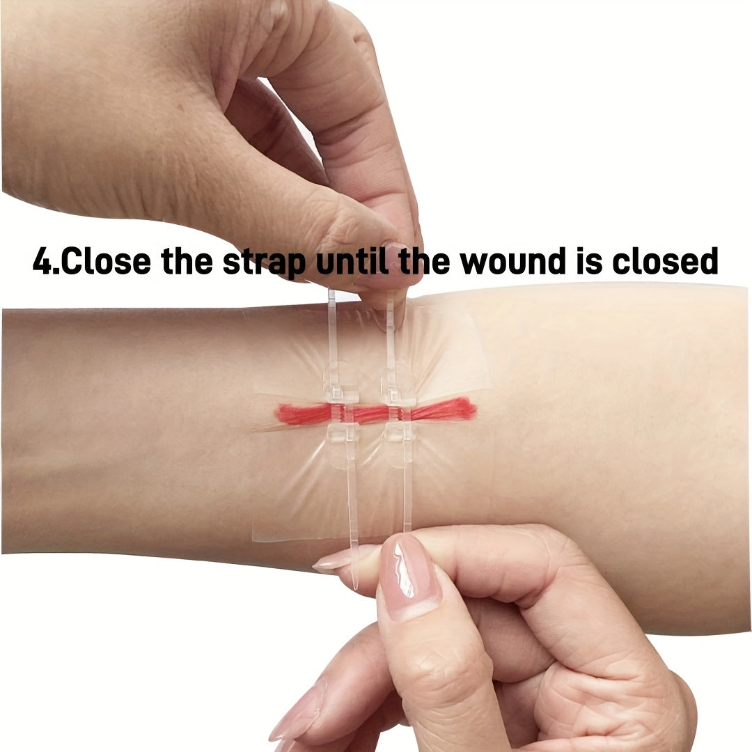 Self-Adhesive Zipper Wound Closure Tape Kit