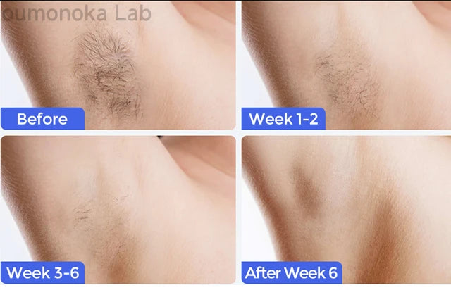 Permanent IPL Laser Hair Remover Epilator