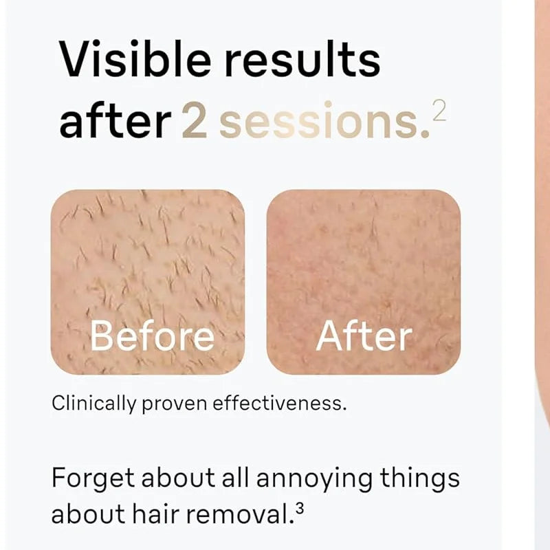 Permanent IPL Laser Hair Remover Epilator
