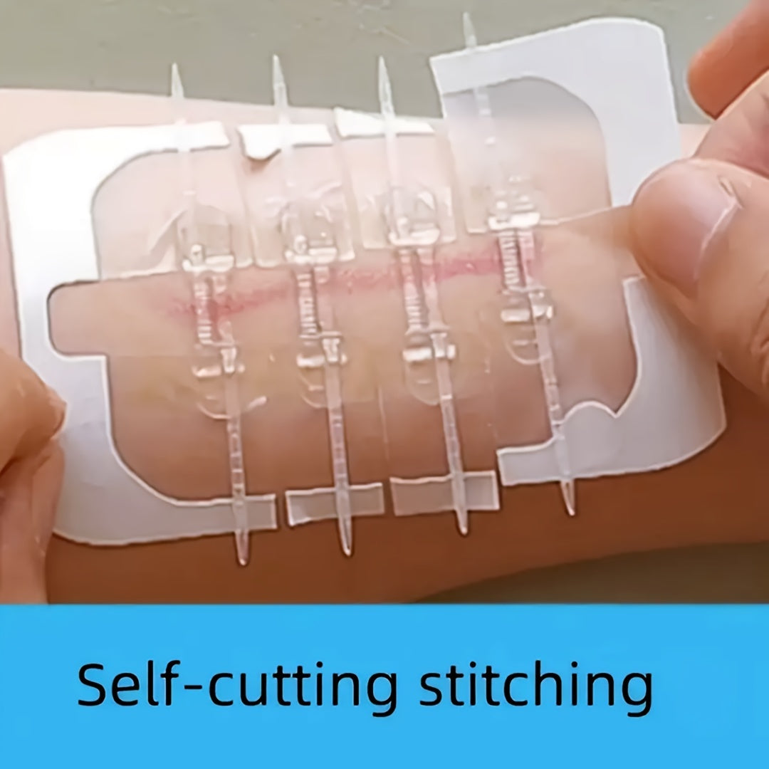 Self-Adhesive Zipper Wound Closure Tape Kit