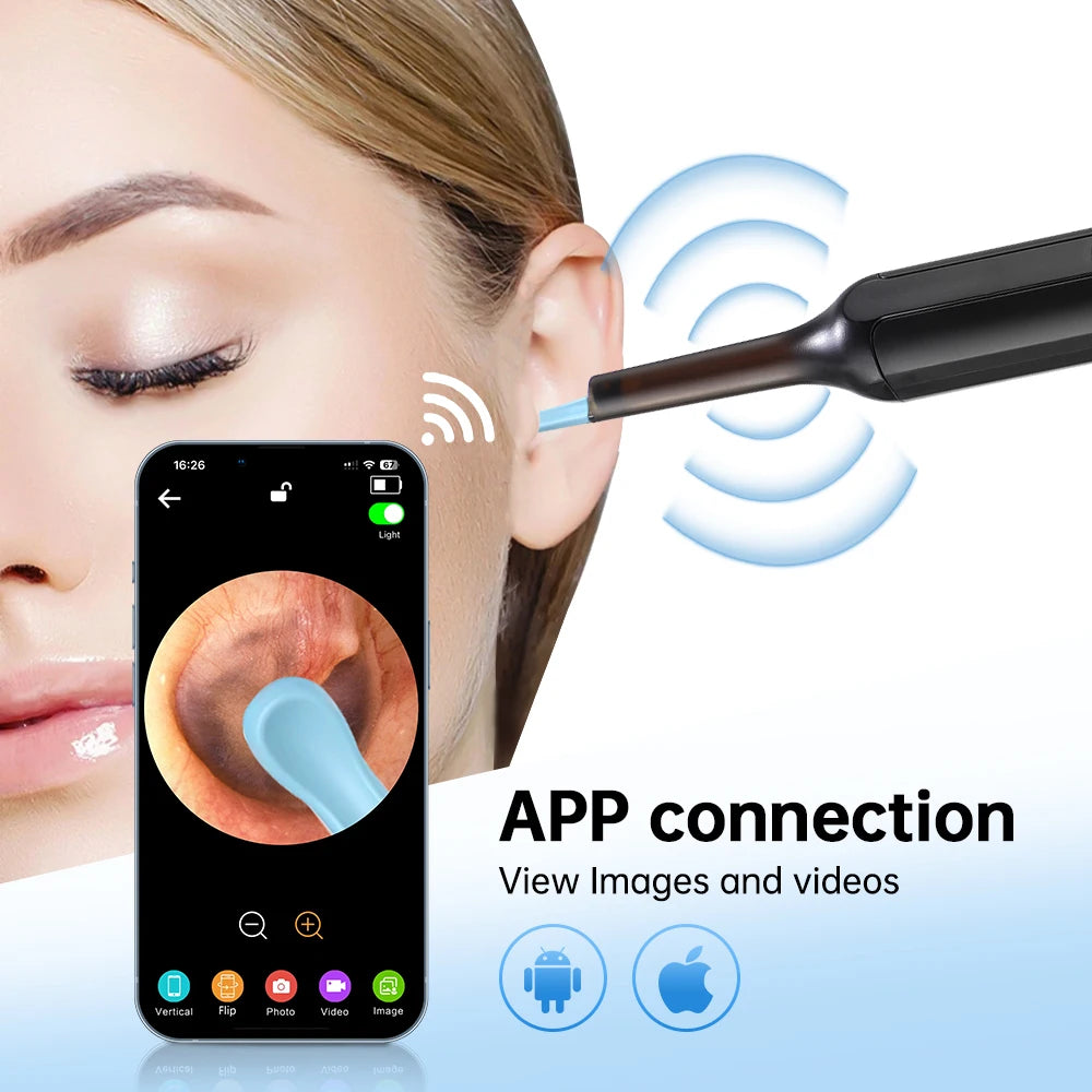 Smart Wireless Visual Earwax Cleaner with HD Camera