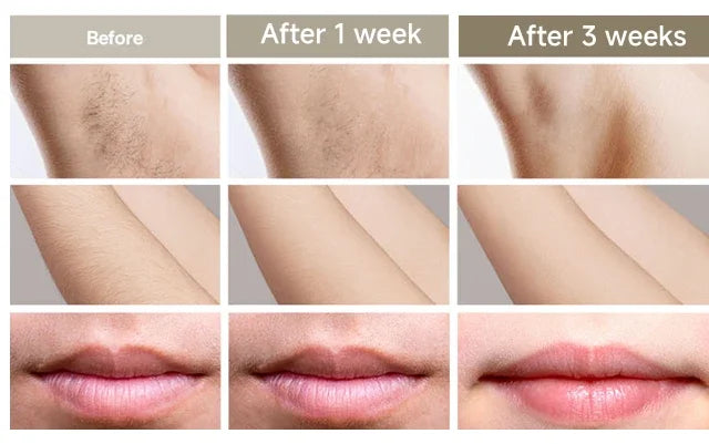 Permanent IPL Laser Hair Remover Epilator